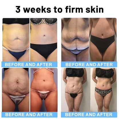 💎ODALIT™ Botox Bee Venom Firming Serum Stick(🔥LAST DAY 70% OFF)🧡