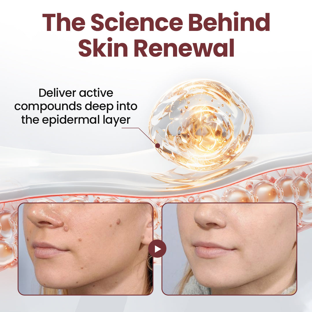 ODALIT™KeraErase Dual-Action Renewal Cream