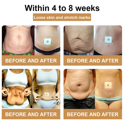 ODALIT™ Bee Venom Lymphatic Drainage Slimming Patch