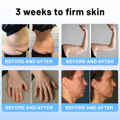 💎ODALIT™ Botox Bee Venom Firming Serum Stick(🔥LAST DAY 70% OFF)🧡