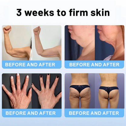 💎ODALIT™ Botox Bee Venom Firming Serum Stick(🔥LAST DAY 70% OFF)🧡