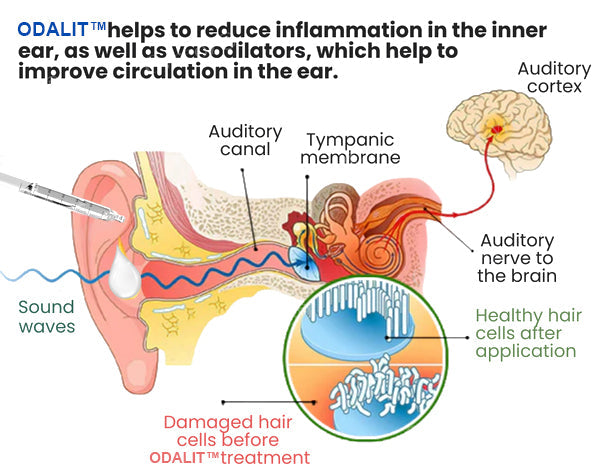 💥ODALIT™ Tinnitus Relief Ear Drops💥