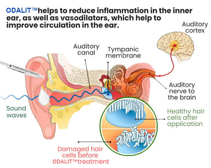 💥ODALIT™ Tinnitus Relief Ear Drops💥