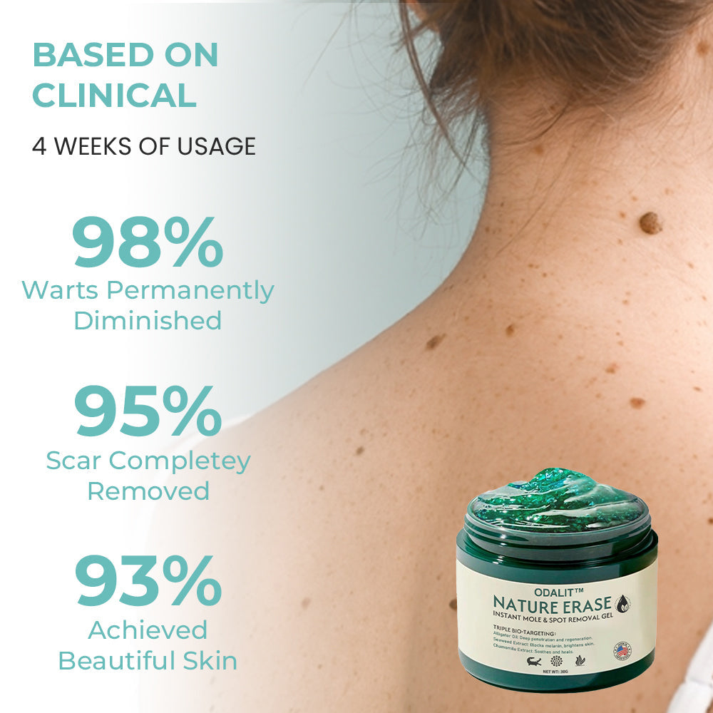 ✅Official Store: ODALIT™ Nature Erase Instant Mole & Spot Removal Gel