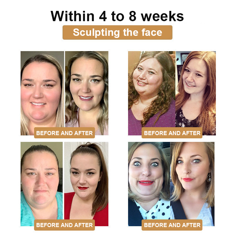 ODALIT™ Bee Venom Lymphatic Drainage Slimming Patch