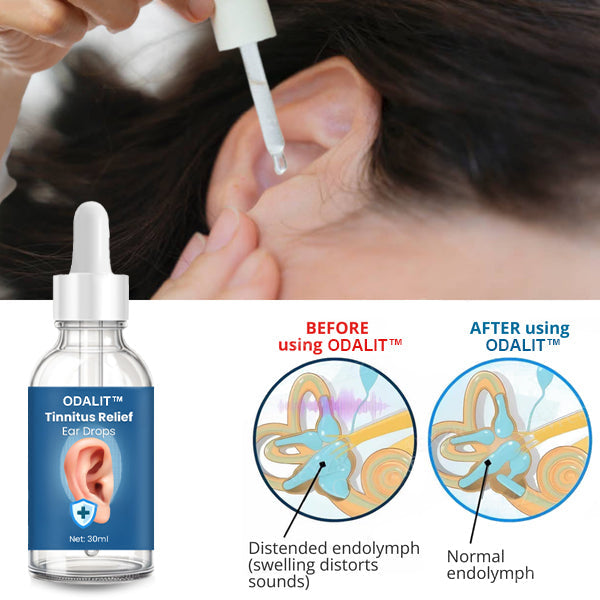 💥ODALIT™ Tinnitus Relief Ear Drops💥