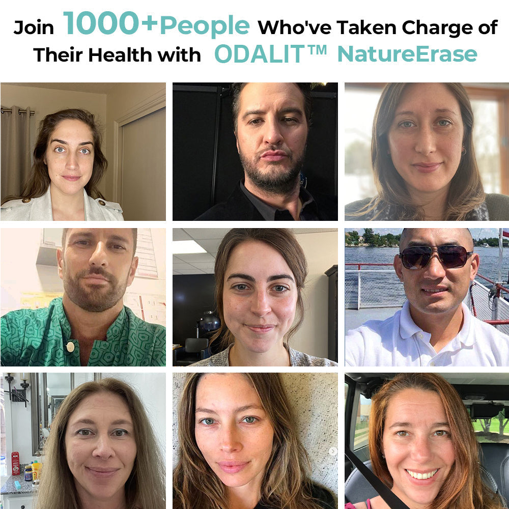 ✅Official Store: ODALIT™ Nature Erase Instant Mole & Spot Removal Gel