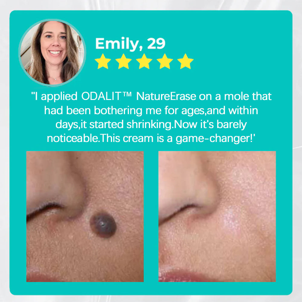 ✅Official Store: ODALIT™ Nature Erase Instant Mole & Spot Removal Gel