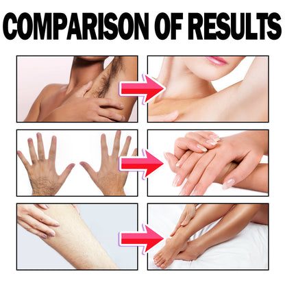 ✨ODALIT™ Hair Removal Mousse for Mrs