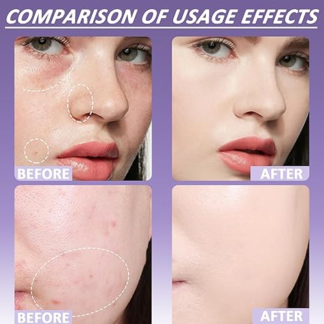 🔥Soft Matte Cream Concealer-Even Through Sweat or Rain